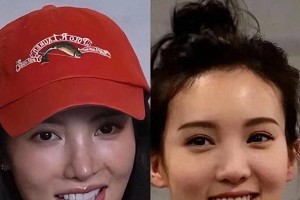 金晨整容上瘾鼻歪嘴斜，资源咖还能翻身吗？