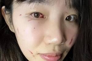 WCBA赛场乱象：外援肘击致毁容 裁判失控引争议